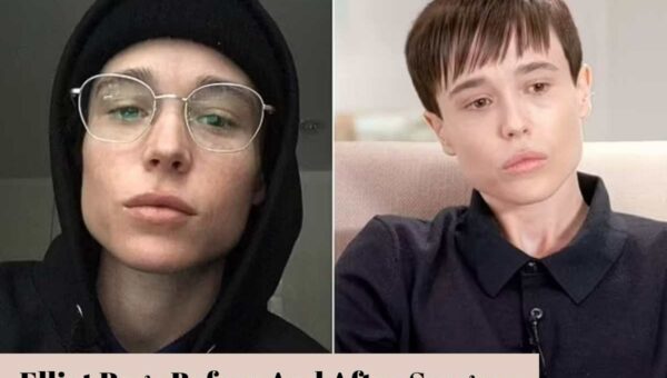 Elliot Page Before And After Surgery Looks