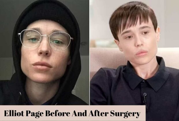 Elliot Page Before And After Surgery