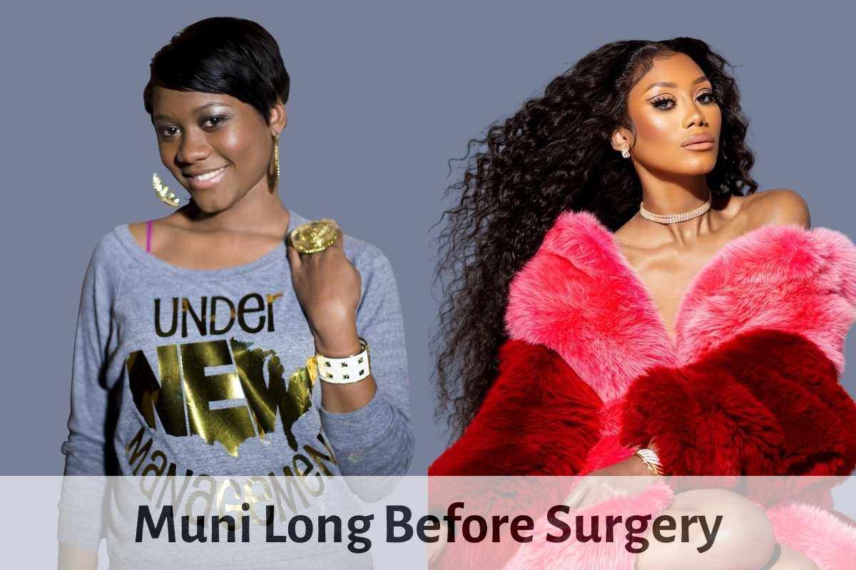 Muni Long Before Surgery