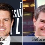 Did Tom Cruise Get Plastic Surgery? Check All Details Here!