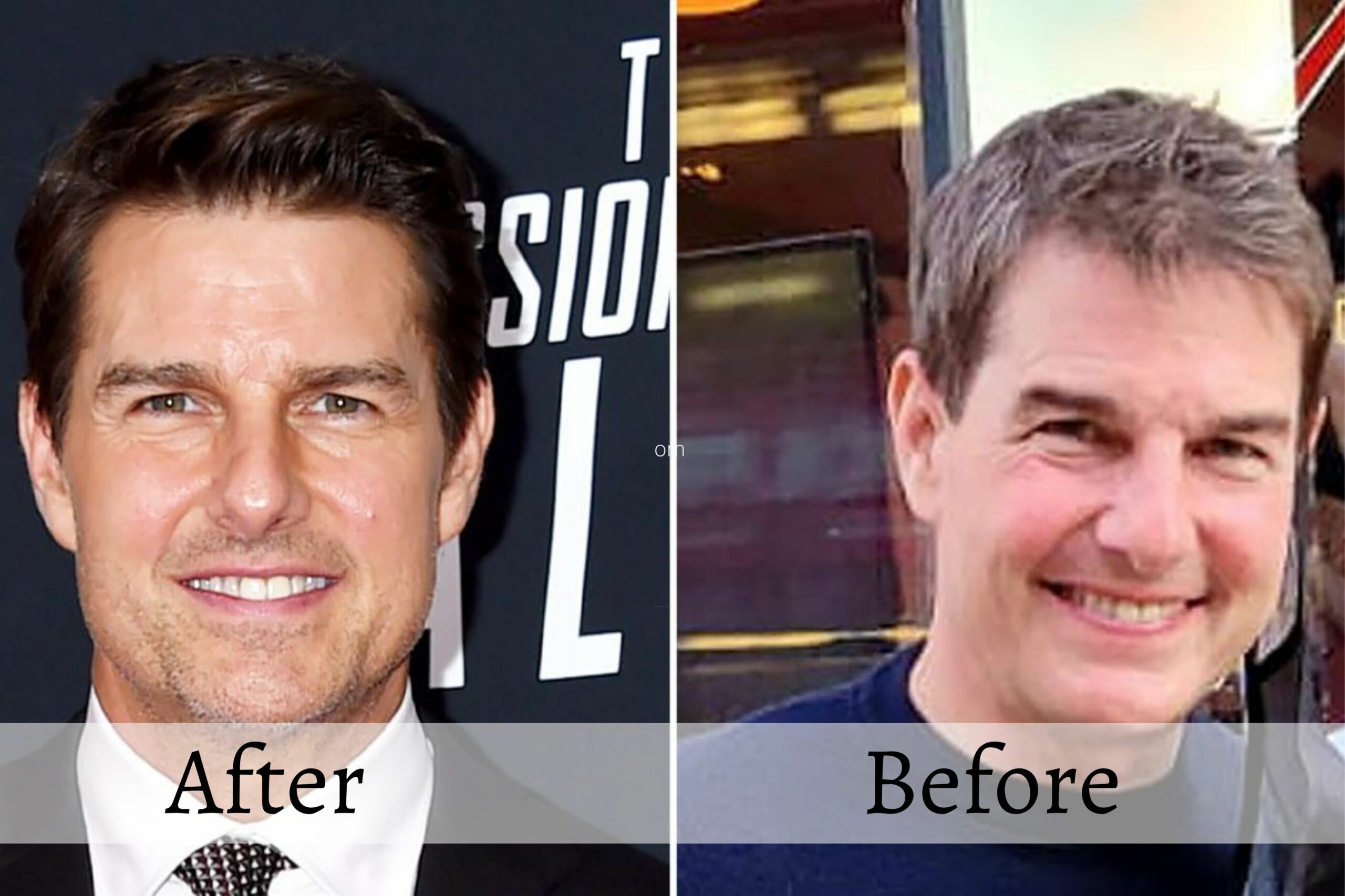 Did Tom Cruise Get Plastic Surgery? Check All Details Here!