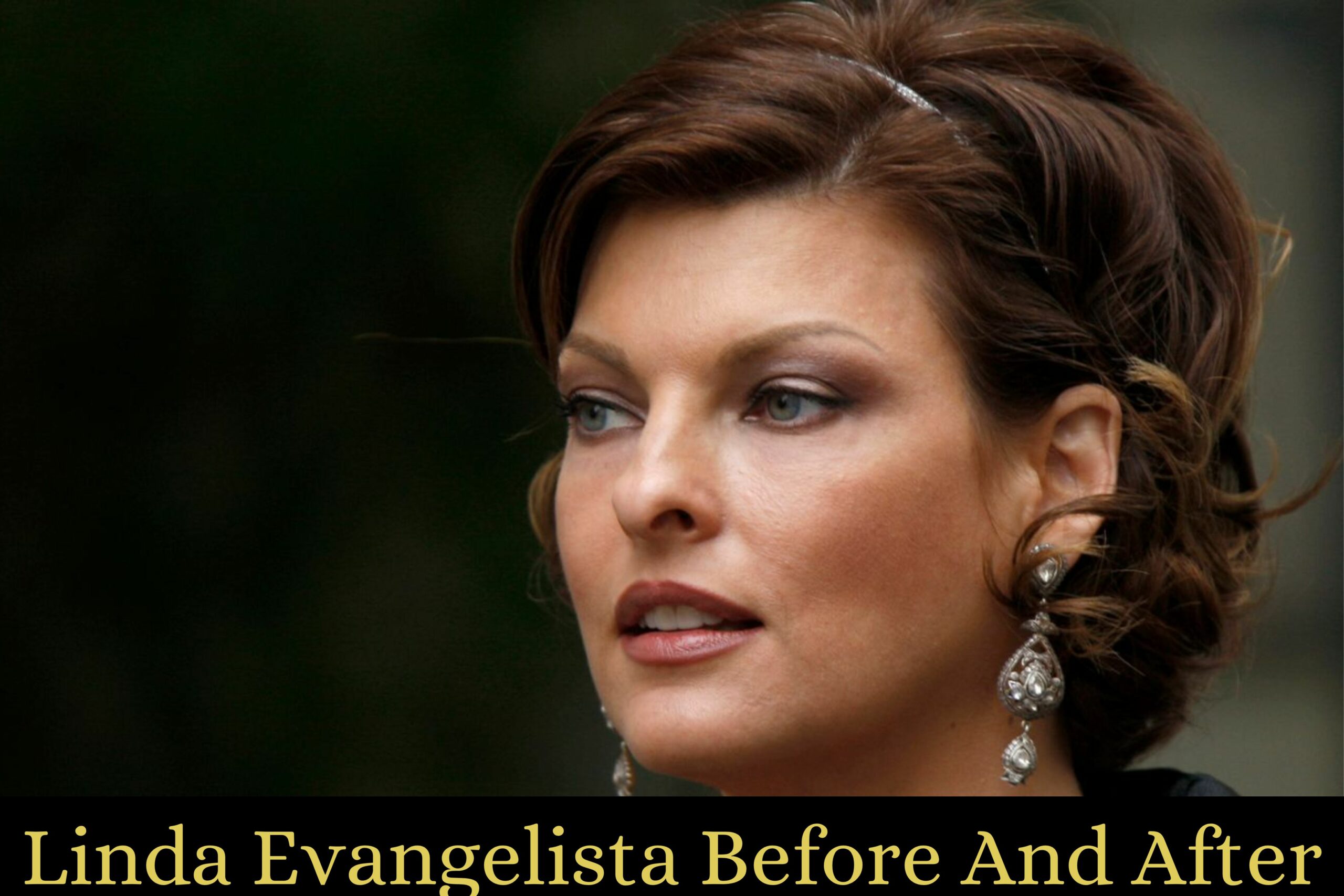 Linda Evangelista Before And After Surgery And What Is Linda Evangelista's Deformity?