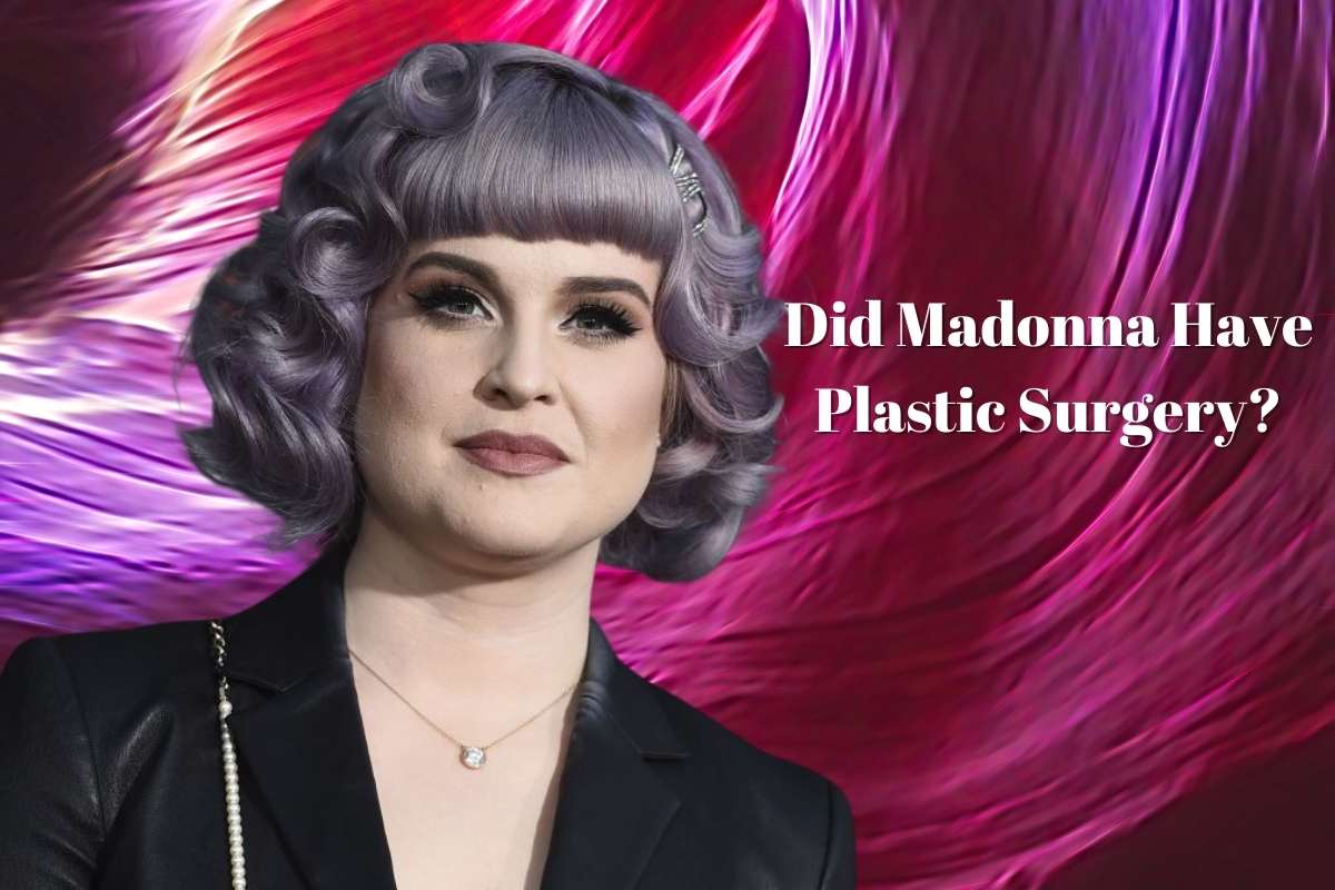 Did Madonna Have Plastic Surgery