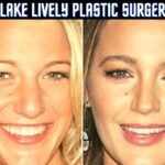 Blake Lively Plastic Surgery