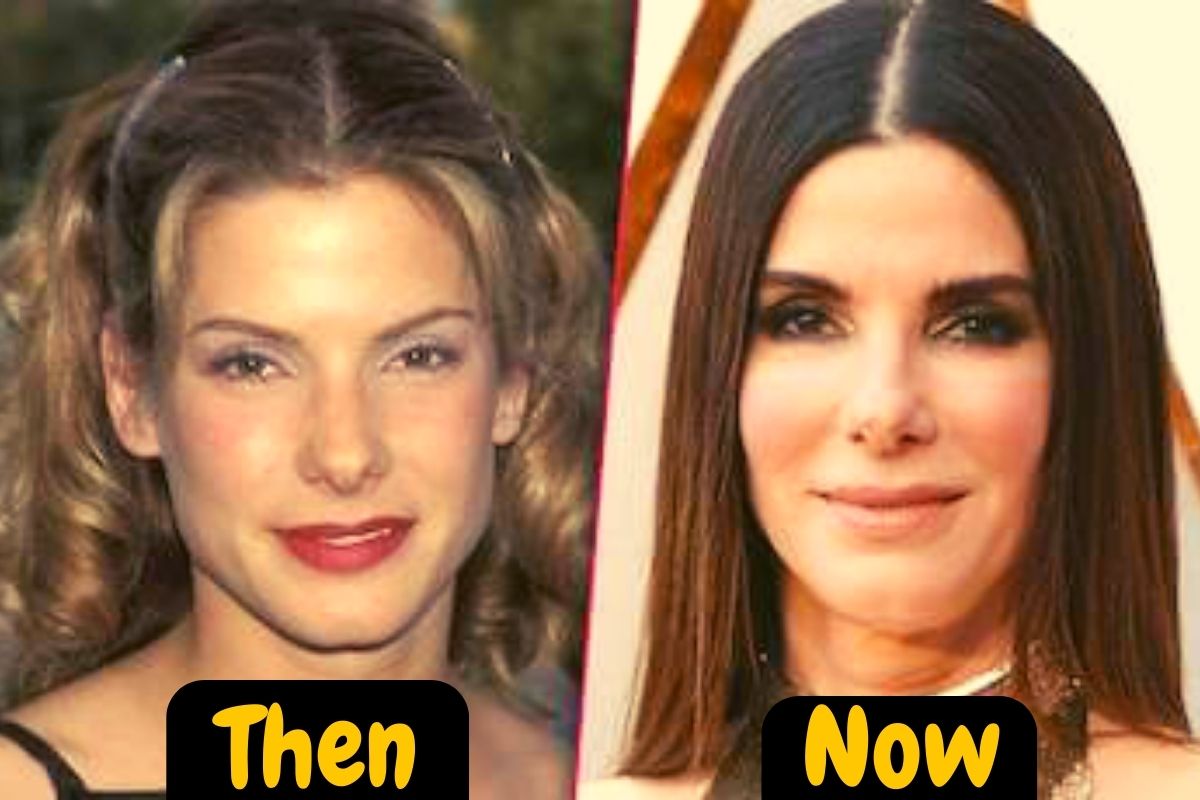 Did Sandra Bullock Have Plastic Surgery Know Here!