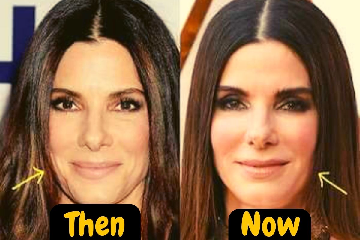 Did Sandra Bullock Have Plastic Surgery: Here's All You Need To Know!