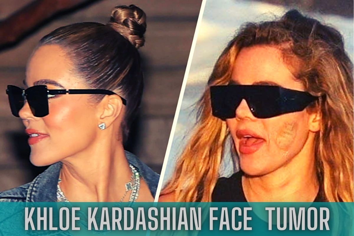 Khloe Kardashian Had Tumor Removed From Her Face