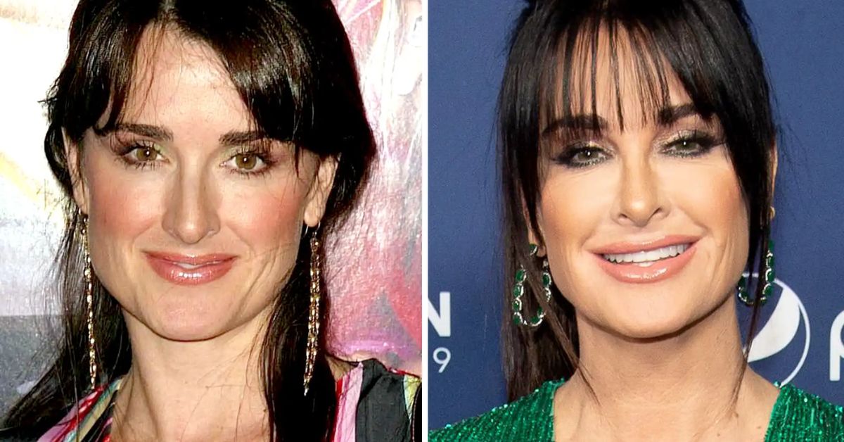 Kyle Richards Before And After (1)