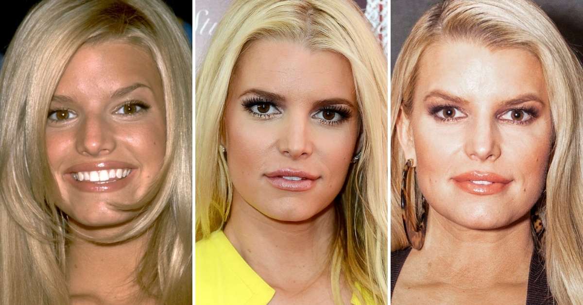 Did Jessica Simpson Admit To Cosmetic Work