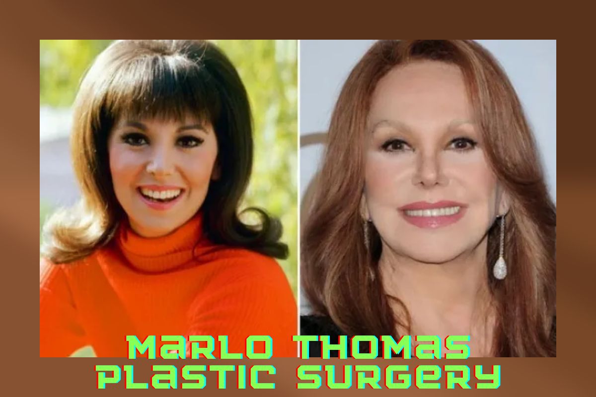 Marlo Thomas Plastic Surgery