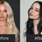 Dove Cameron Before and After Plastic Surgery