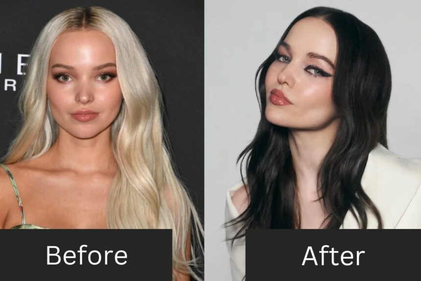 Dove Cameron Before and After Plastic Surgery