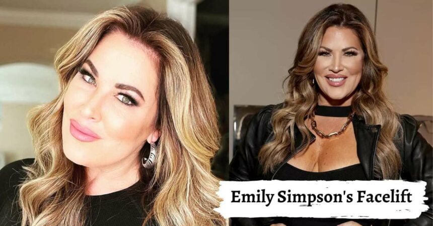 Emily Simpson's Facelift Ahead Of Season 17, Before & After Photos