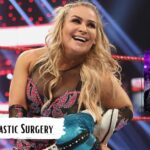 Natalya Plastic Surgery: WWE Diva's Makeover, See The Before And After Pictures!