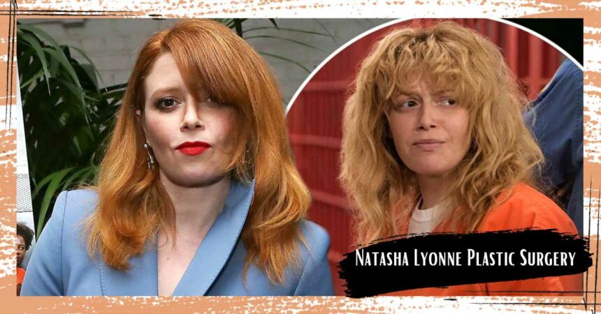 Natasha Lyonne Plastic Surgery: A Look At Her Suspected Plastic Surgery Procedures