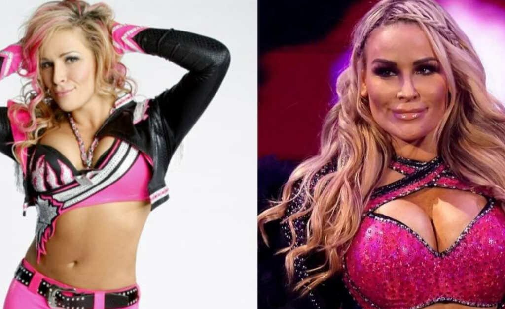 natalya plastic surgery