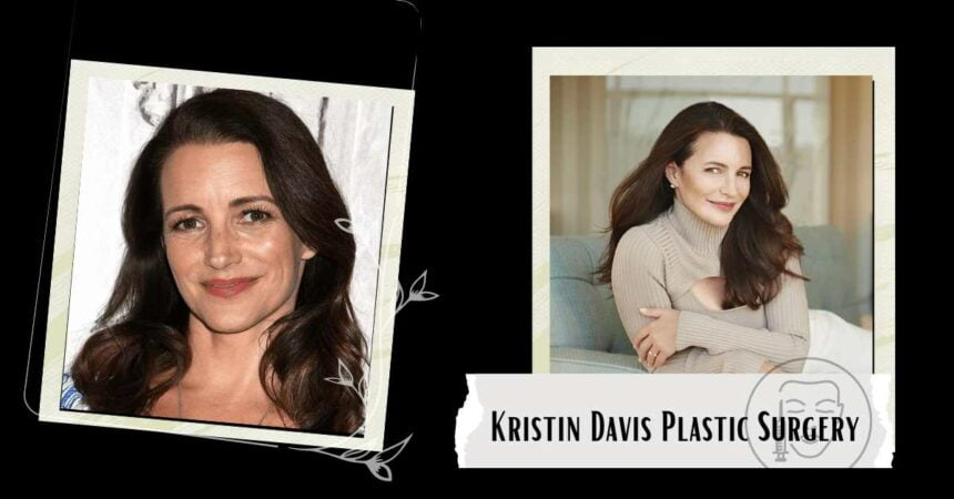 Kristin Davis Plastic Surgery: In The Past, Fans Have Wondered About This