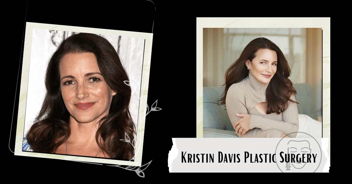 Kristin Davis Plastic Surgery, In The Past, Fans Have Wondered About This