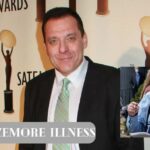 Tom Sizemore Illness, Critically Condition From A Brain Aneurysm