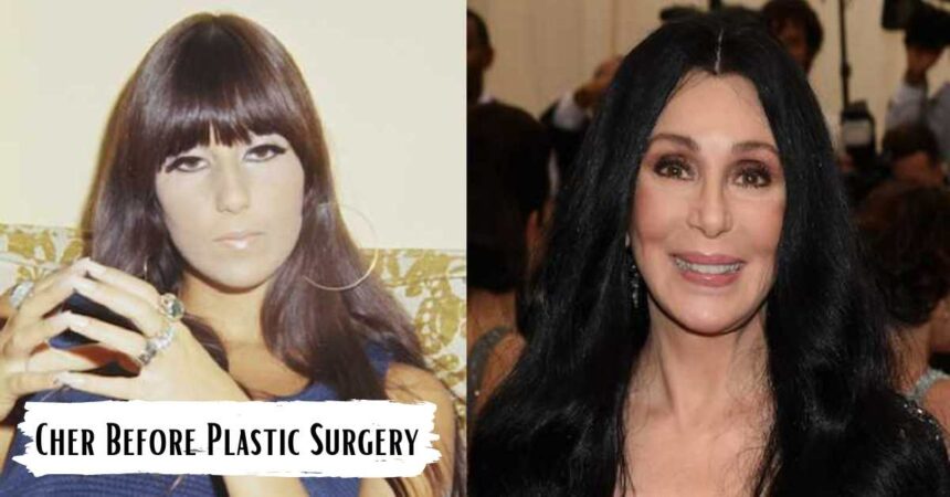 Cher Before Plastic Surgery, Flawless Face Has Changed Over Time