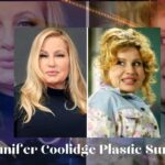 Jennifer Coolidge Plastic Surgery