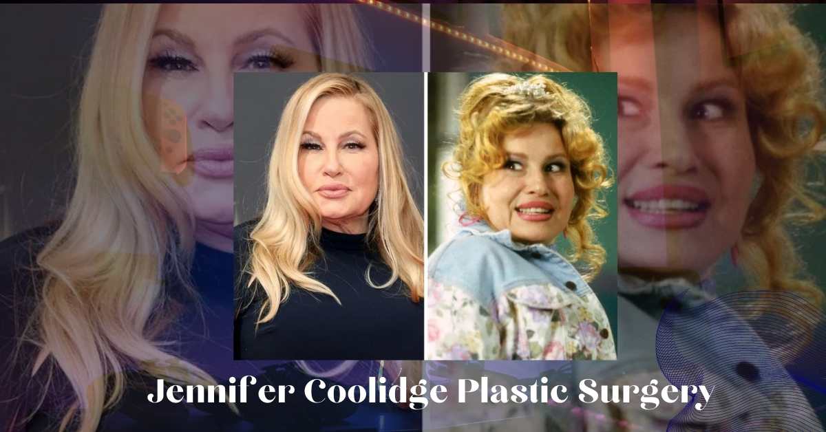 Jennifer Coolidge Plastic Surgery