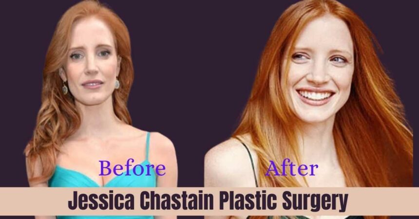 Jessica Chastain Plastic Surgery