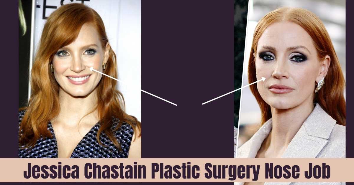 Jessica Chastain Plastic Surgery Nose Job