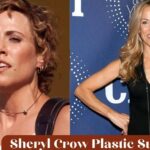 Sheryl Crow Plastic Surgery