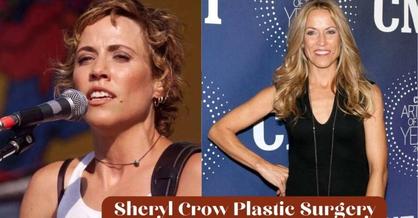 Sheryl Crow Plastic Surgery