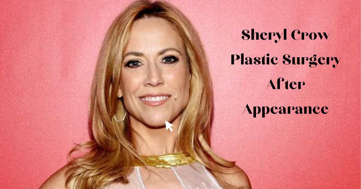 Sheryl Crow Plastic Surgery After Appearance