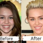 The Truth About Miley Cyrus' Plastic Surgery Rumors