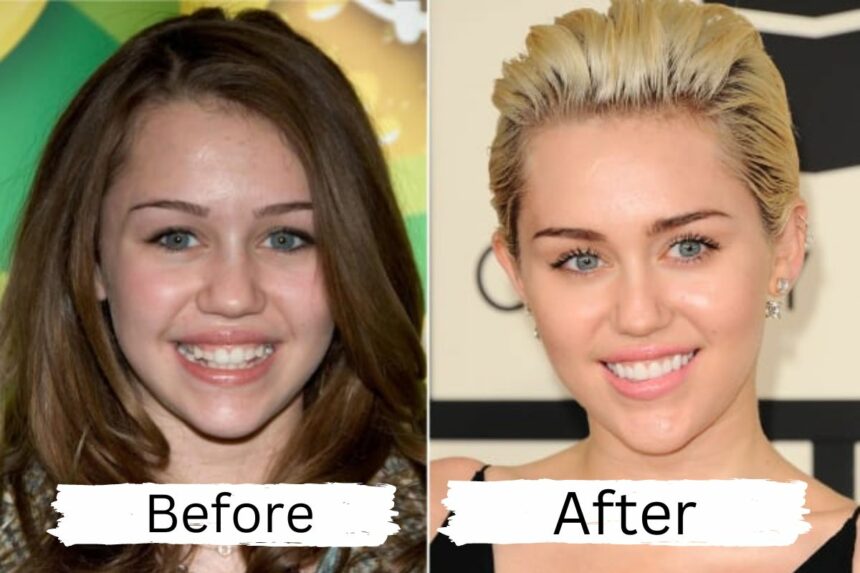 The Truth About Miley Cyrus' Plastic Surgery Rumors