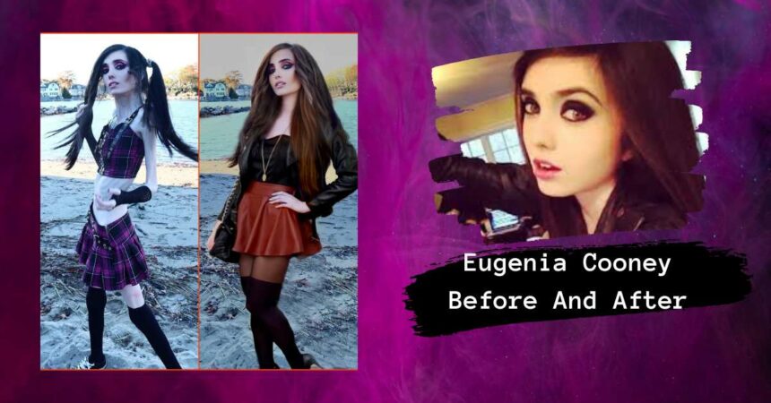 Eugenia Cooney Before And After: Why Food Will Never Be Your Adversary?