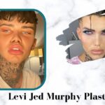 Levi Jed Murphy Plastic Surgery: The Social Media Influencer Spent £30,000 on Cosmetic Procedures!