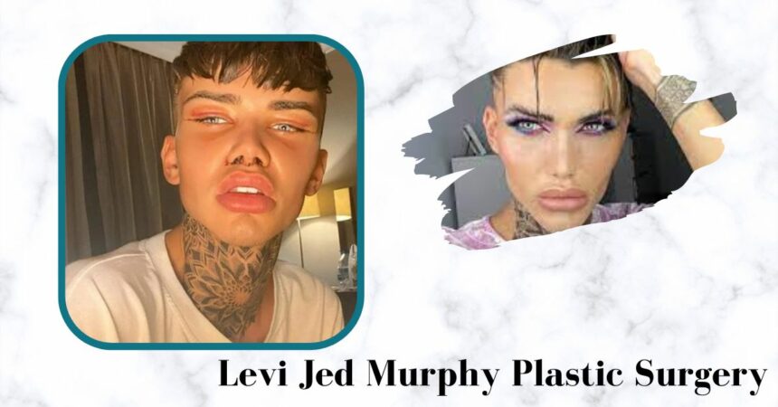 Levi Jed Murphy Plastic Surgery: The Social Media Influencer Spent £30,000 on Cosmetic Procedures!