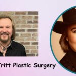 Travis Tritt Plastic Surgery