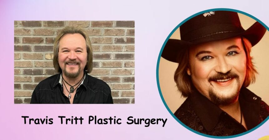 Travis Tritt Plastic Surgery