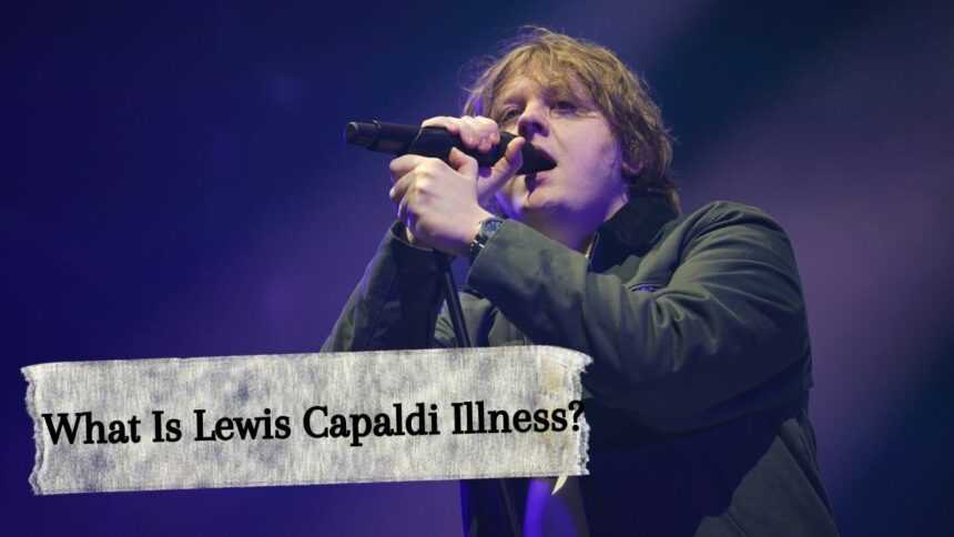 What Is Lewis Capaldi Illness? ‘It Is Something He Is Living With’