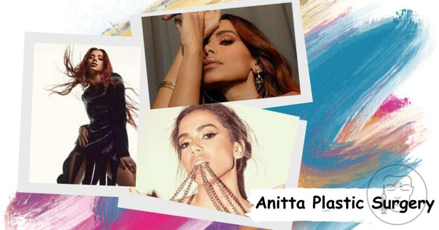 Anitta Plastic Surgery: Unveiling The Truth Behind Her Cosmetic Enhancements