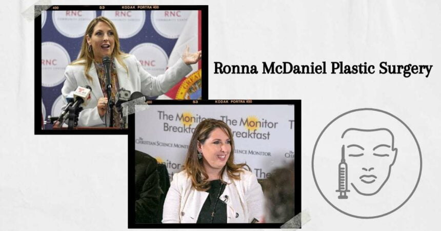 Ronna McDaniel Plastic Surgery: Did She Go Under The Knife?