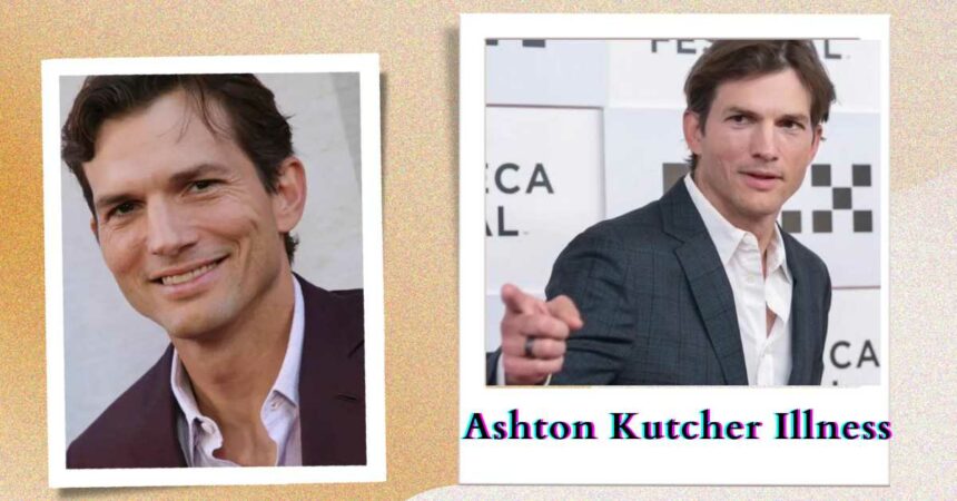 Ashton Kutcher Illness