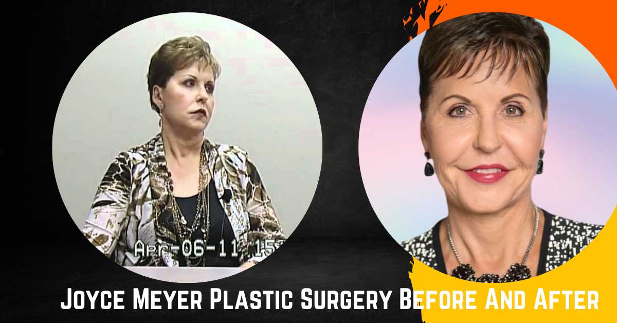 Joyce Meyer Plastic Surgery Before And After