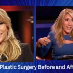Lori Greiner Plastic Surgery Before and After Photos 
