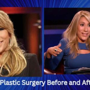 Lori Greiner Plastic Surgery Before and After Photos 