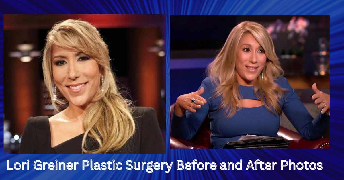 Lori Greiner Plastic Surgery Before and After Photos 