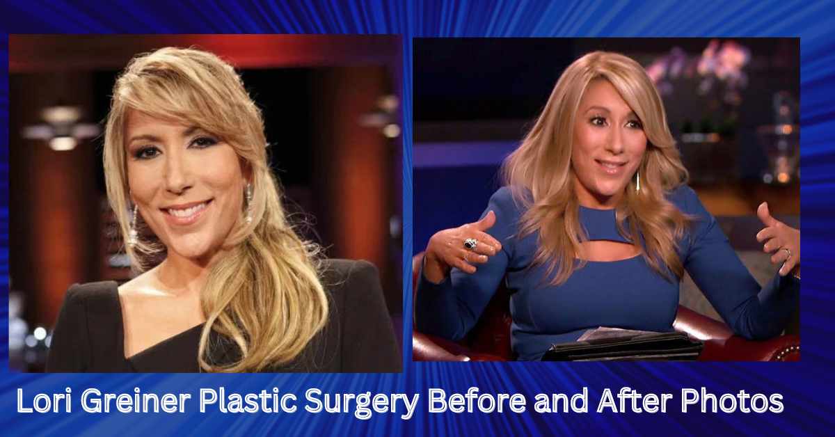 Lori Greiner Plastic Surgery The Real Mysteries Behind Her Youthful Glow Lake County News