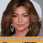 Shania Twain Plastic Surgery