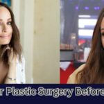 Catt Sadler Plastic Surgery Before And After
