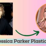 Sarah Jessica Parker Plastic Surgery